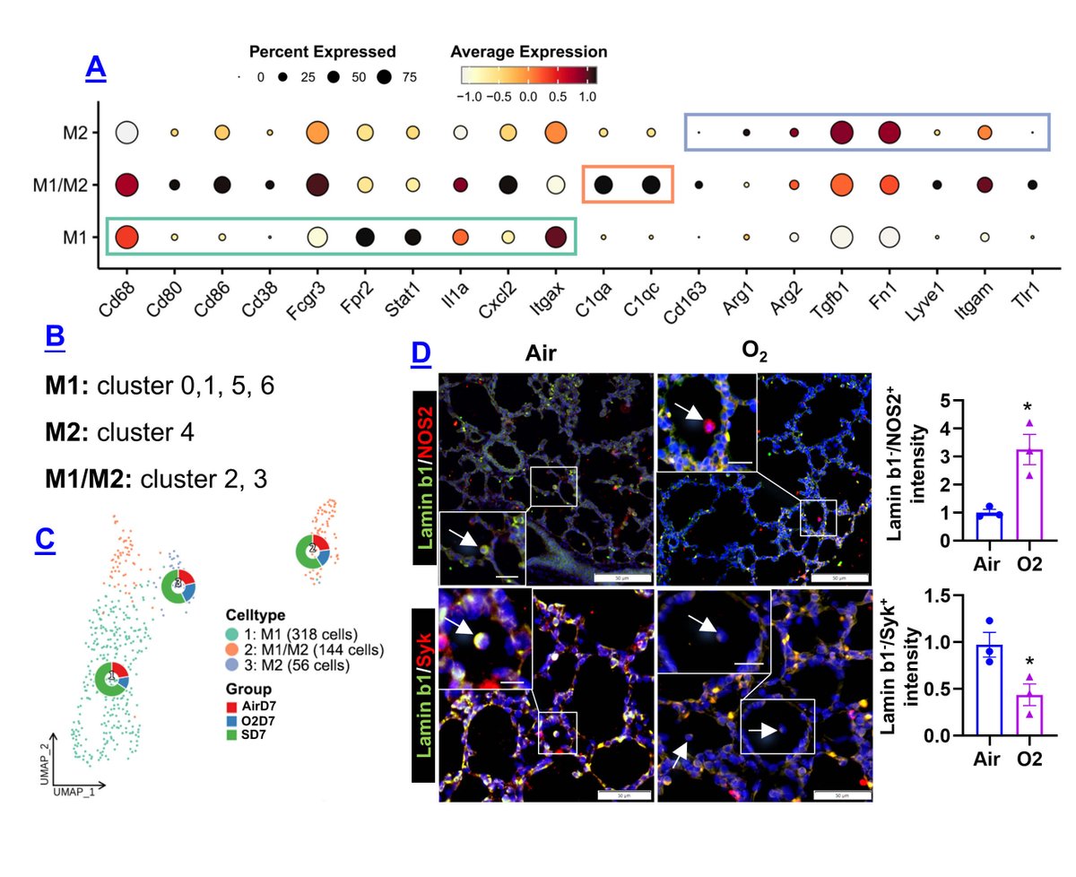 Landmark_IMR's tweet photo. Are we missing a key factor in how neonatal hyperoxia drives persistent lung injury in bronchopulmonary dysplasia?

👉 Explore the full study: https://t.co/yYJbFlpttf

This study reveals a dominant population of metabolically reprogrammed senescent macrophages shaping inflammatory signaling and explores targeting senescence and metabolism as a novel therapeutic avenue.

✒️ Authors: Fanjie Lin, Elena Pineda, Bethany McGonnigal, Joselynn Wallace, Wenju Lu, Phyllis A. Dennery, Hongwei Yao (Corresponding author)
🏪 Affiliation: The First Affiliated Hospital of Guangzhou Medical University; Providence VA Medical Center; Brown University @BrownUniversity 

Welcome to submit your work via our submission link👉: https://t.co/wHF8lp2GCr
FBL is dedicated to the publication of original articles, reviews, methods and commentaries in all areas of cellular and molecular biology.
📖  Click here for author guidelines: https://t.co/EBITEzbjBy

#Neonatology #Pulmonology #BronchopulmonaryDysplasia #Immunometabolism #LungInjury #Research #FBLPaper