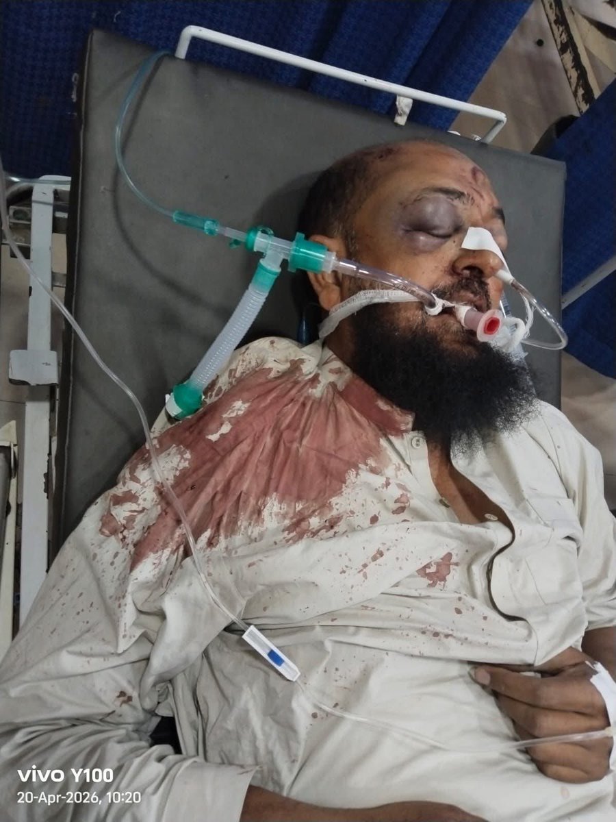 حیدرآباد زون کے وفادار کارکن فہیم بیگ صاحب، جو گزشتہ دنوں ایک روڈ حادثے میں شدید زخمی ہوئے تھے، اب وفات پا گئے ہیں۔ اللہ تعالیٰ مرحوم کو اپنی جوارِ رحمت میں جگہ عطا فرمائے اور ان کی مغفرت فرمائے، آمین