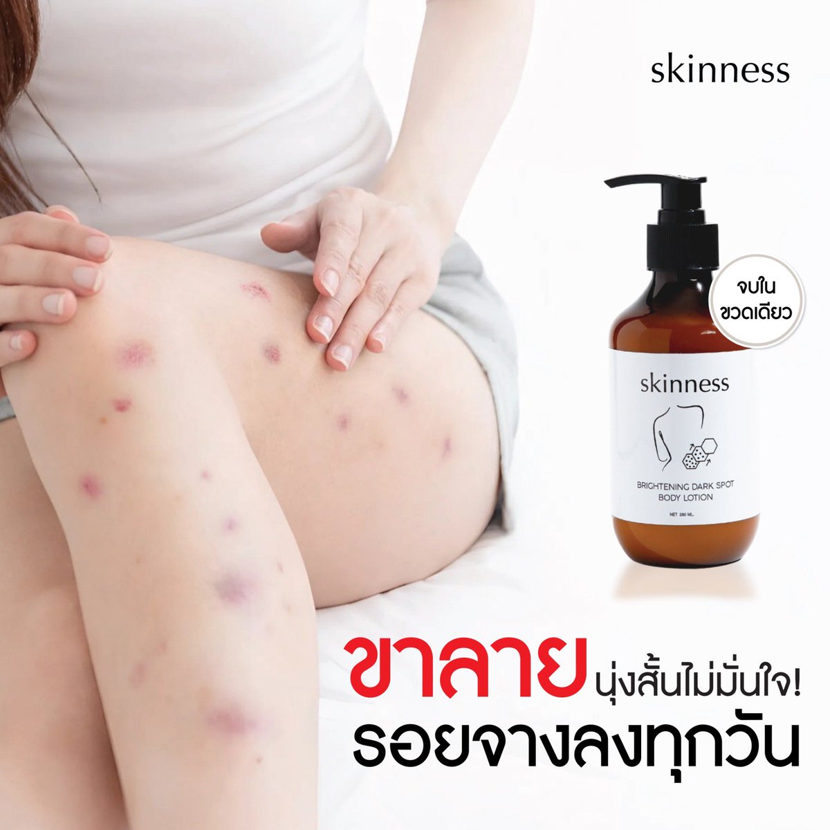 skinness official tweet media