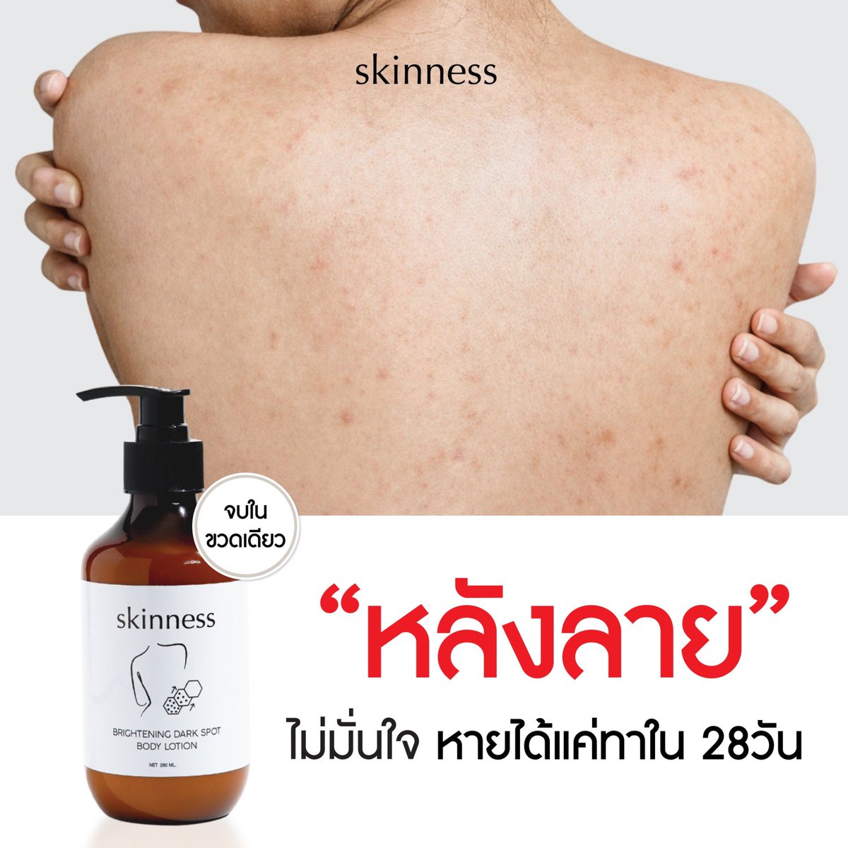 skinness official tweet media