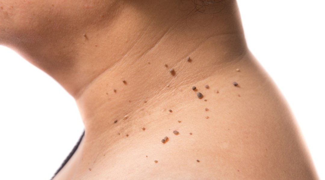 Hans Collin tweet media