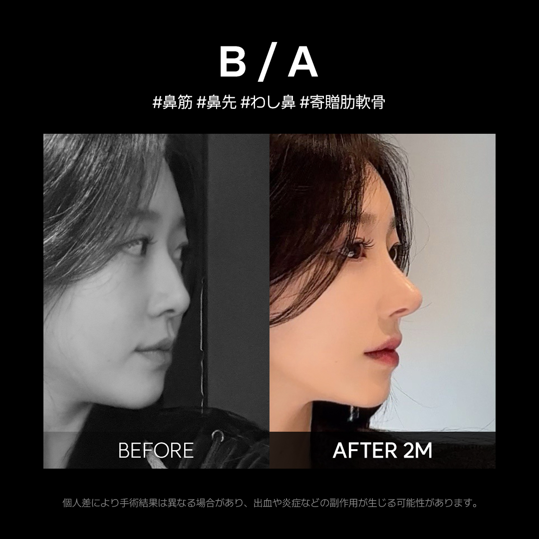 ルーヴル美容外科 tweet media