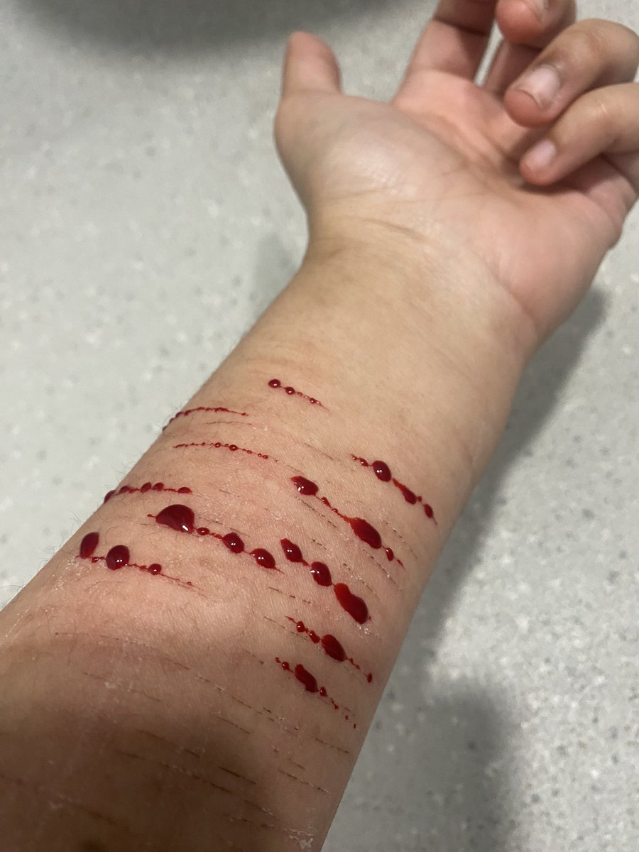 Esurient tweet media