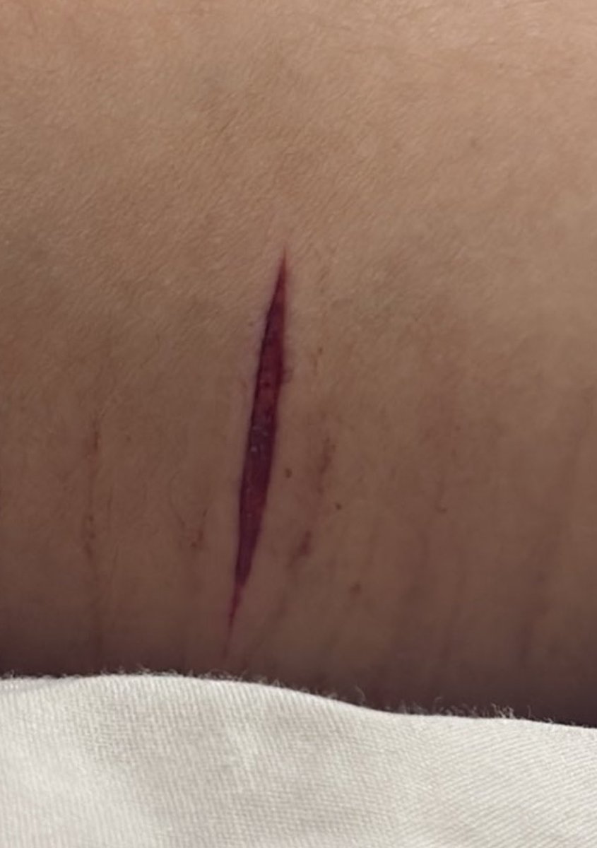 Hiko 🧸 || Yuji of shedtwt tweet media