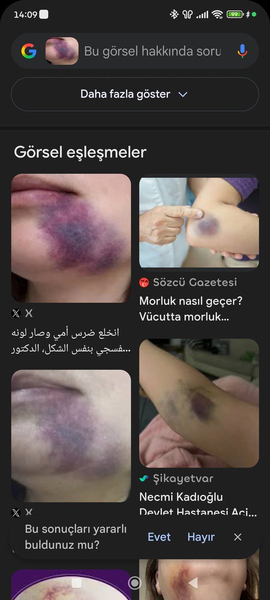Polyannaangel's tweet photo. @SevgiAsk1905 🤭🤭 https://t.co/5fRQfi3mxy