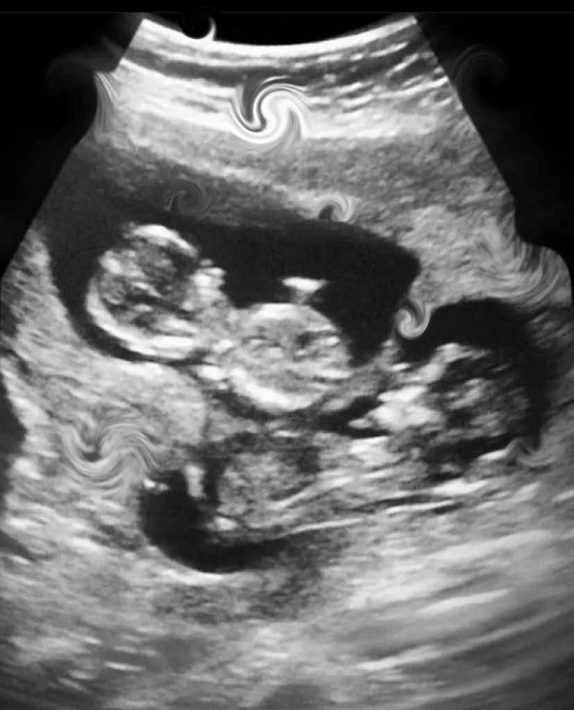 ハミガキコ tweet media