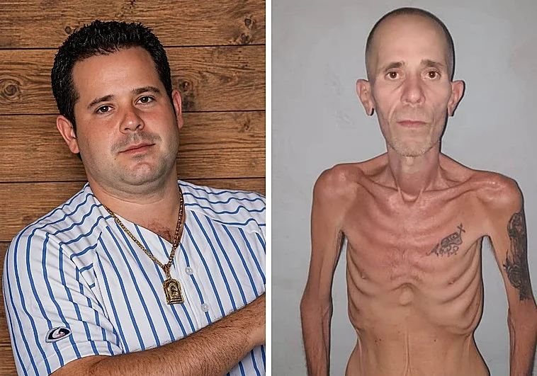 Miren, zurdos de mierda, a esta persona que ingresó en la cárcel en Cuba en 2018 (en la primera foto) y cómo salió después de cinco años (en la segunda foto).

A todos ustedes que defienden a la revolución cubana solo les deseo el mismo destino para cada uno de sus familiares,