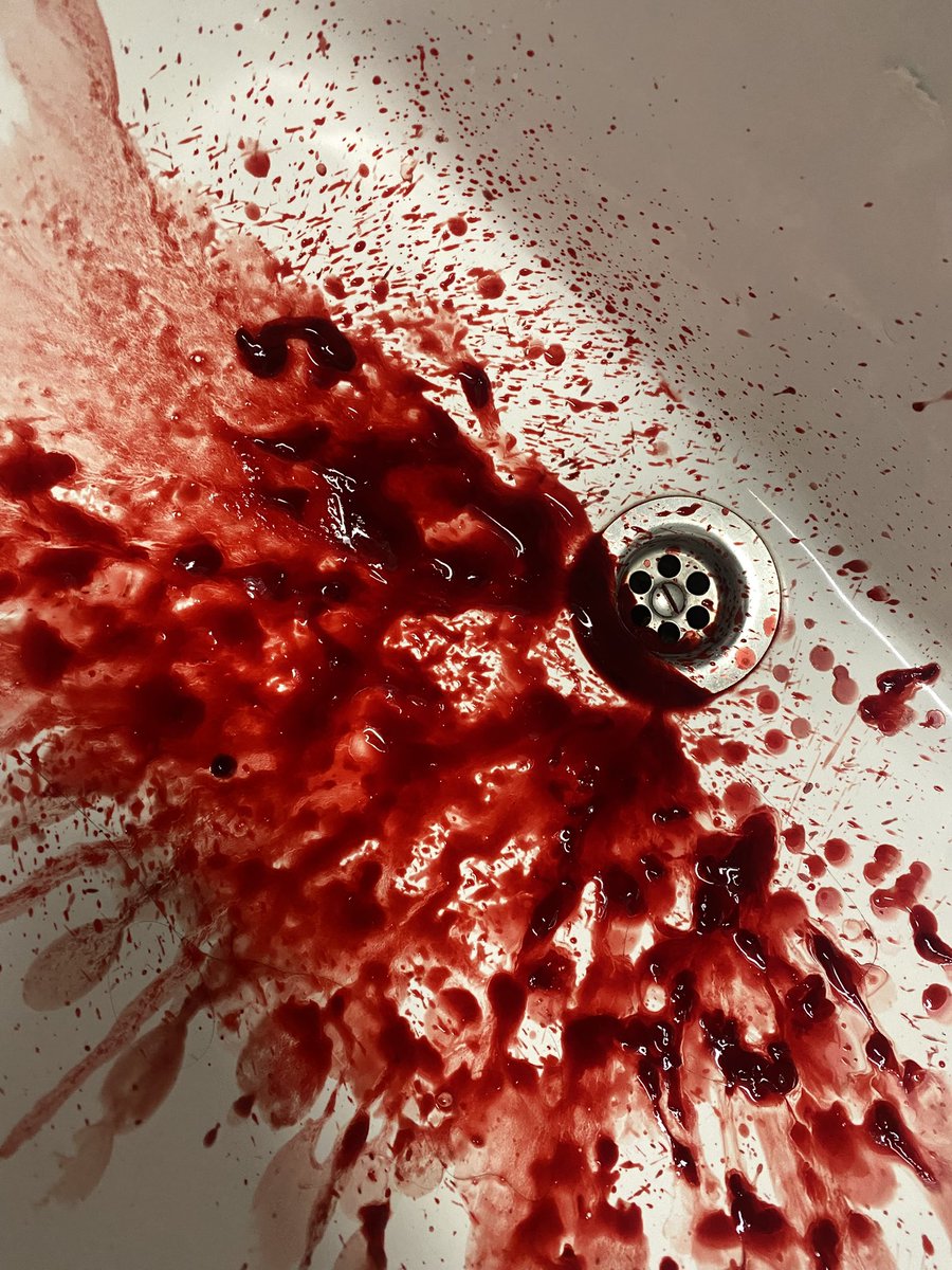 isabella / rag doll of shedtwt 🪽 tweet media