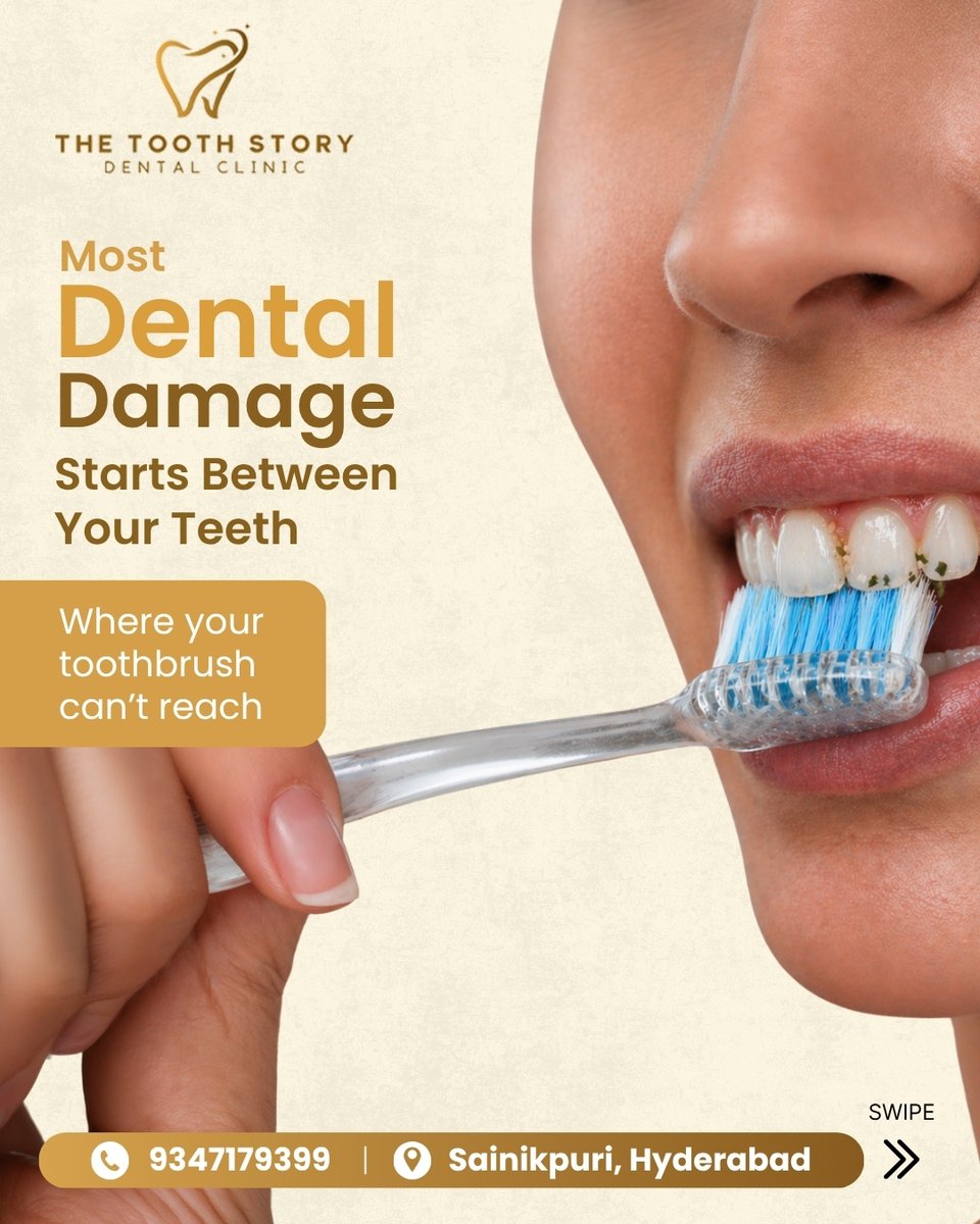 thetoothstory's tweet image. Floss daily, it’s a small habit with big impact 😁

Prevents bad breath, gum infections &amp;amp; hidden cavities.

Don’t skip what your toothbrush can’t reach!

📞 93471 79399
📍 Sainikpuri, Hyderabad

#FlossDaily #OralHealth #HealthySmile #DentalCare