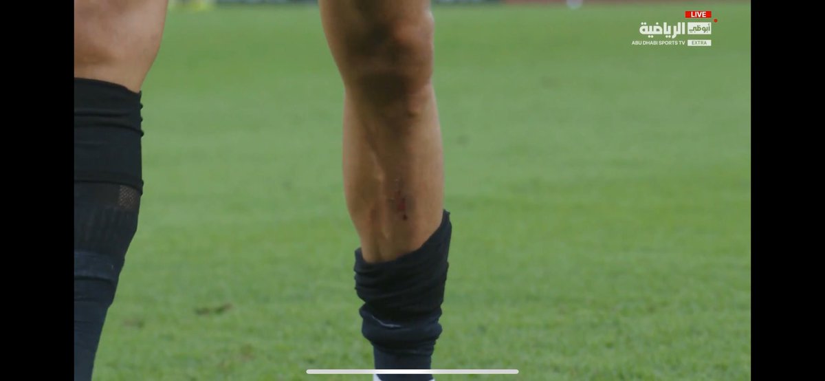 محماس tweet media