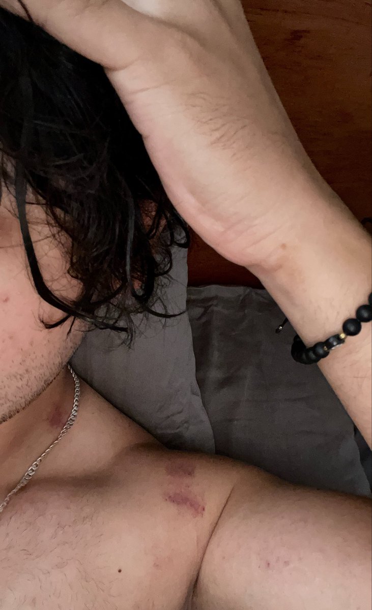 𝐆𝐢𝐚𝐧𓆰𓆪 tweet media