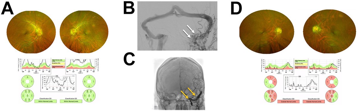 Ophthalmology tweet media