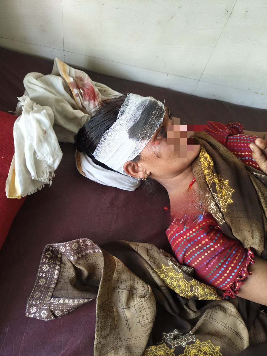 vimalbrambaba's tweet photo. #accident
बरमबाबा चौराहे के समीप दो मोटरसाइकिलों की टक्कर से एक महिला व दो लोगों के सर में गंभीर चोट थी, मैने तुरंत सभी घायलों को अपनी निजी गाड़ी में बैठालकर 10 मिनट के अंदर बिजुआ अस्पताल पहुंचाया।
@nitin_gadkari @Uppolice @CMOfficeUP @MoHFW_INDIA @dayashankar4bjp @DmLakhimpur https://t.co/kbUJehlpMO