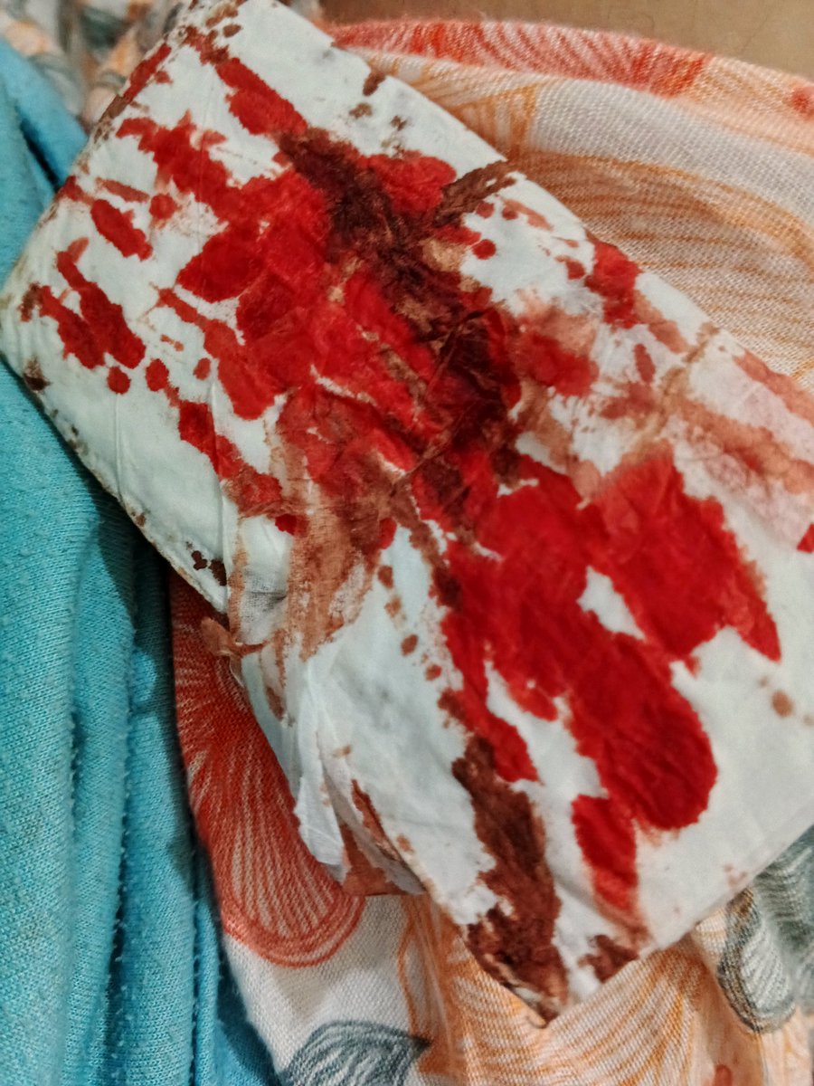 kokonywan's tweet image. bloodied tissue mmmmh #shtwt #shedtwt #slittwt