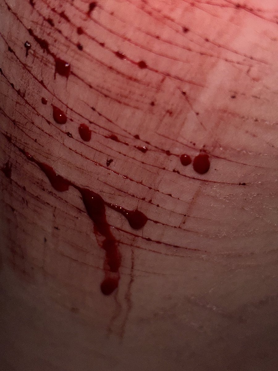 Hunter of 988TWT☁︎｡⋆𓂃ོ tweet media