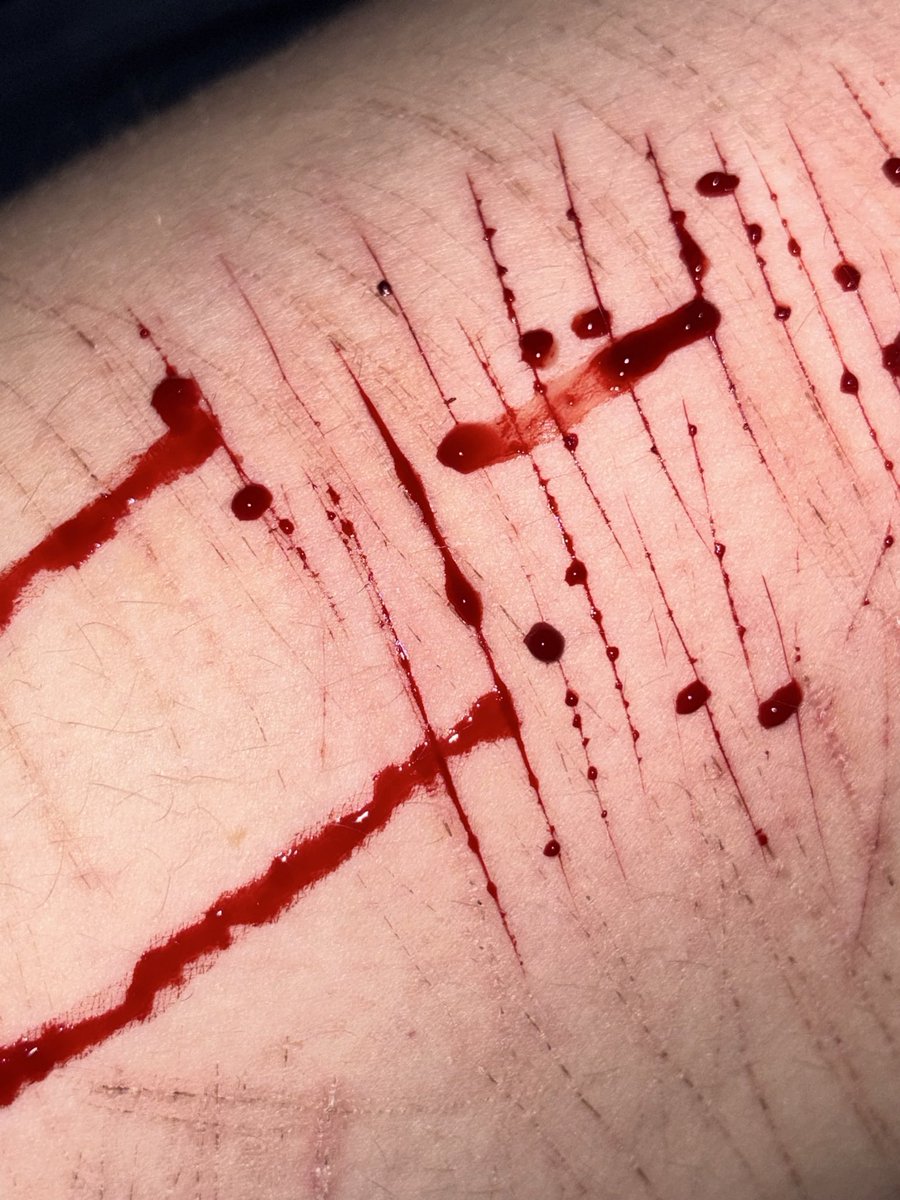 Hunter of 988TWT☁︎｡⋆𓂃ོ tweet media