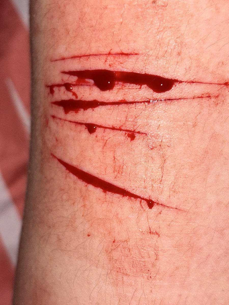 Hunter of 988TWT☁︎｡⋆𓂃ོ tweet media