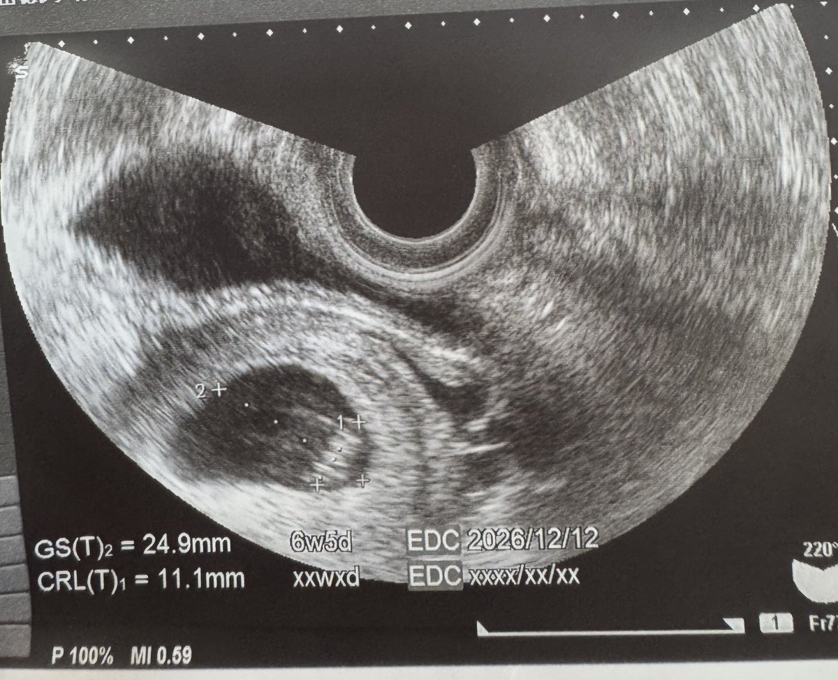 シン・虎徹 tweet media