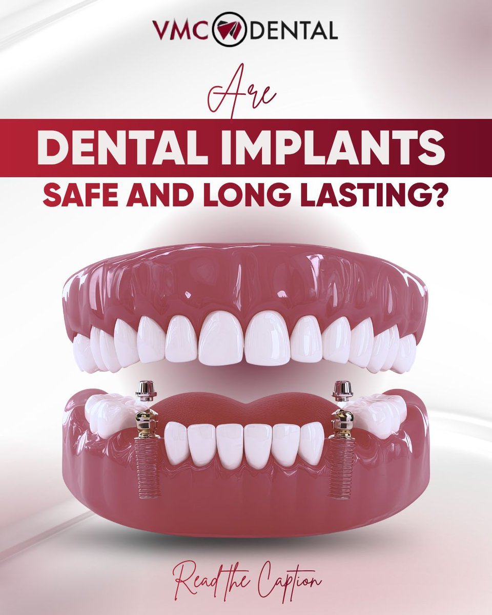 vmc_dental's tweet photo. Thinking about dental implants? Read this first 👇
Dental implants are a safe, long-lasting way to replace missing teeth. They look, feel, and function like natural teeth and can last decades with proper care.
Success depends on healthy gums, good hygiene, and expert planning. https://t.co/TQWpcgG4vk