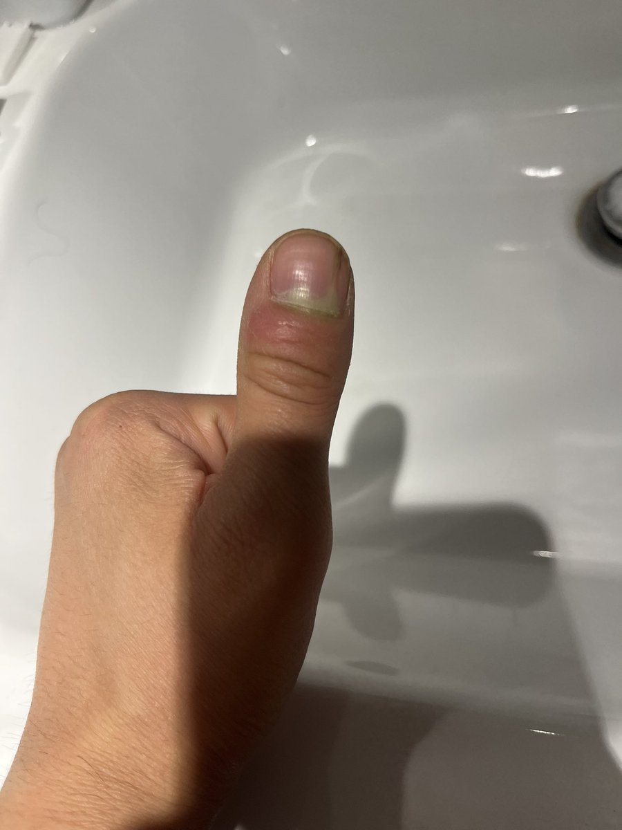 élie ☂️ tweet media