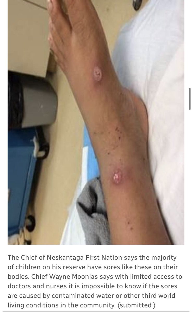 Terrill Tailfeathers tweet media