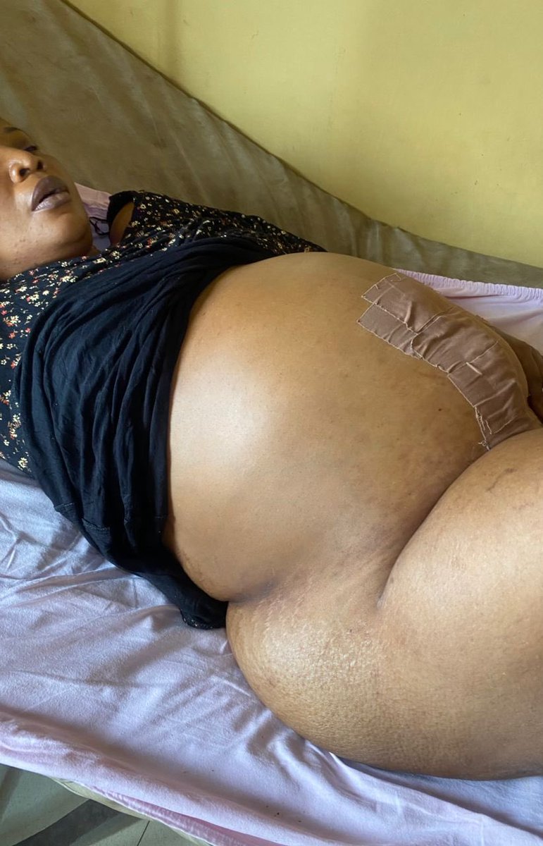 ZAllstreet's tweet photo. Justice for Blessing!!!

OAR Medical Centre in Ilepo, Abule Egba, Lagos, operated on my sister on March 28. Just 4 hours after the surgery, they gave her milk and Milo. I objected, but they forced me out and still gave it to her.

We didn’t know the worst had already happened — https://t.co/cU1HPupE43