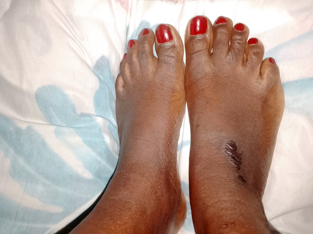 BMishy63665's tweet photo. Red would look good on your shoulders don't you think 🤭#onlyfans #feetfetish #soles #footfisting https://t.co/z4uS8Hljpc