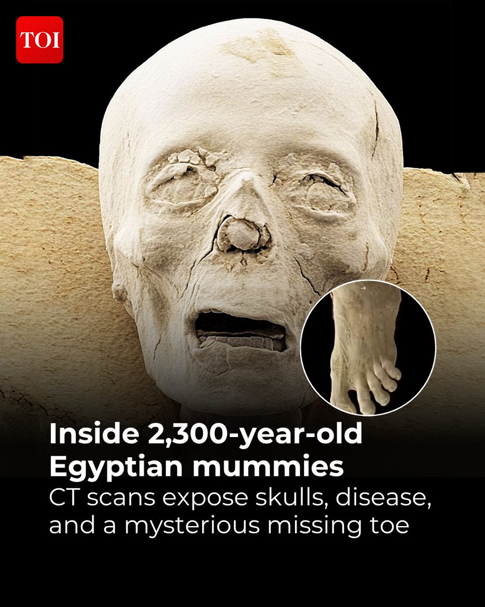 timesofindia's tweet image. The latest imaging work on ancient #Egyptian remains has brought unusual clarity to mummified body parts that were sealed for over two millennia. Scientists using advanced #CT and 3D scanning technology have examined limbs, skulls, and a foot that dates back more than 2,300