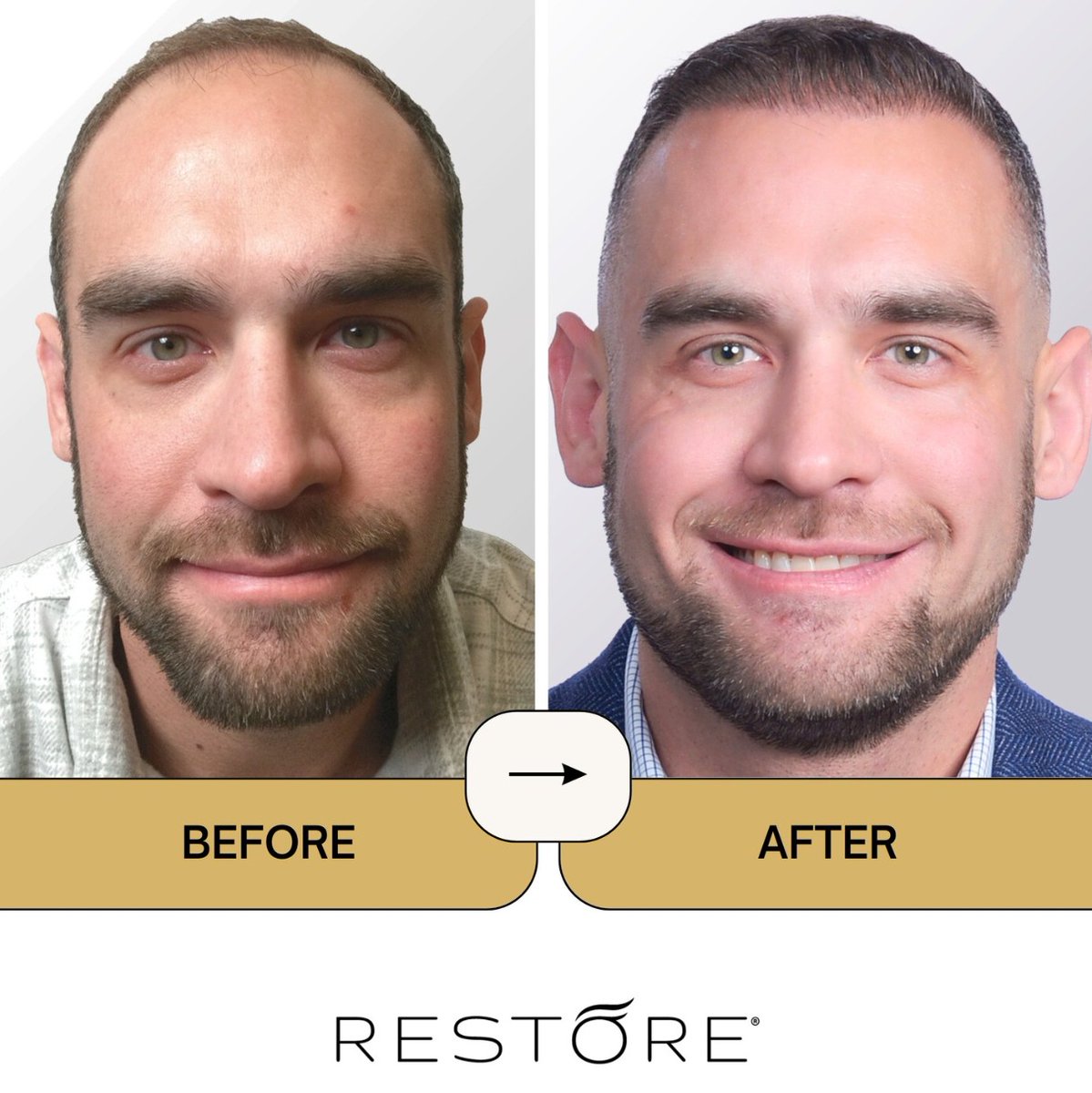 RESTORE Hair tweet media