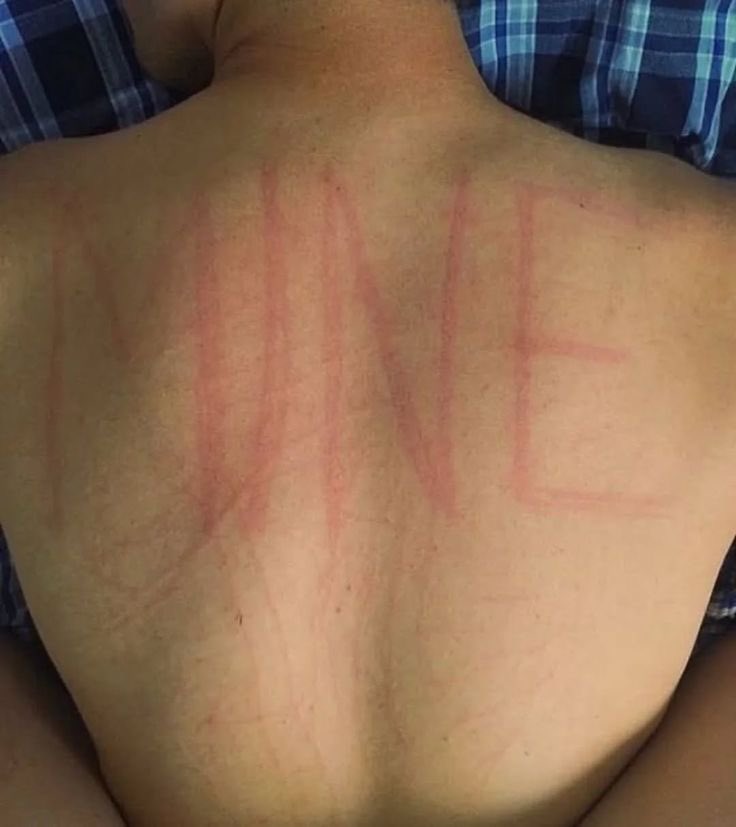 (☢益☢𝑬𝒎𝒓𝒆☢益☢) tweet media