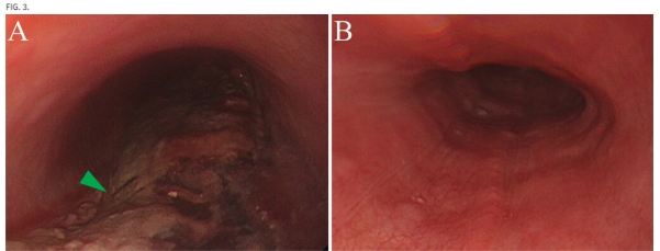 Journal of Neurosurgery tweet media