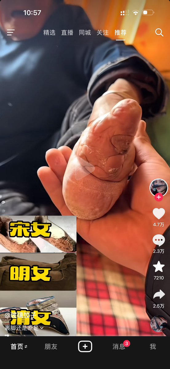 bitebibsc's tweet photo. 我的太奶奶的脚🦶🏻也这样🥲 
小时候还带我，陪伴了我儿童时光～

虽然小脚、但是很坚强，还上了3儿4女。
然后有了我爷爷 $BTC 
然后有了我爸爸$ETH
然后有了我儿子$BNB 

https://t.co/BZHnWP9C9c https://t.co/BAZLn9S9SA