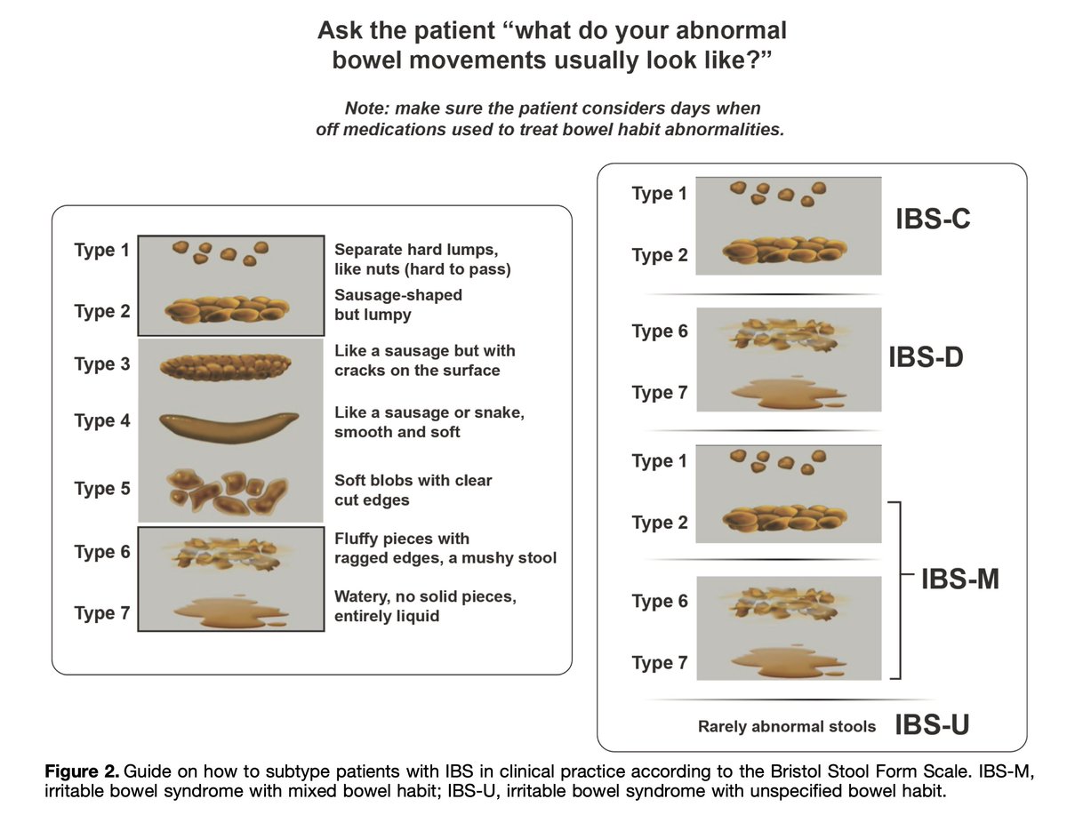 drkeithsiau's tweet photo. Rome V practical takeaways for Bowel Disorders (BDs) 💡🔢

1️⃣ Diagnostic criteria of IBS subtypes ✅
2️⃣ How to subtype IBS using stool chart 💩
3️⃣ History taking for BDs 💬
4️⃣ Diagnostic evaluation for BDs 🧠

📸: @AGA_Gastro  https://t.co/oq4pC3Ng7l https://t.co/kzx7DLj38n