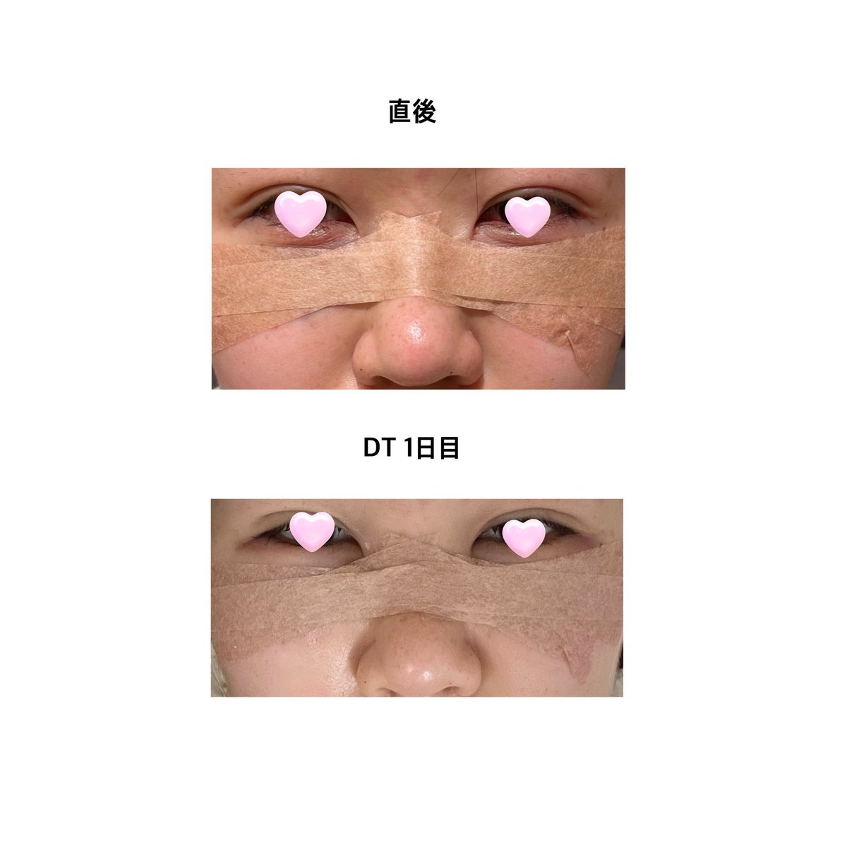 美容に課金したいOLちゃん🍎 tweet media