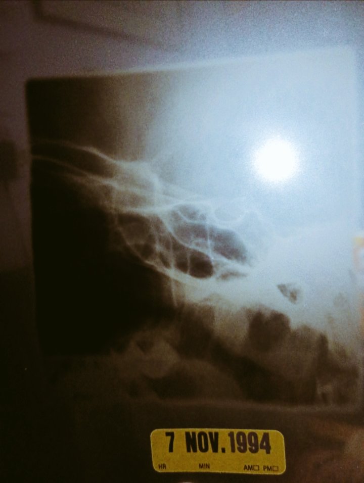 Bret Corey 👑⚜️🏵️ tweet media