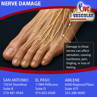 Ivascularcenter's tweet photo. Nerve damage (neuropathy) occurs when the peripheral nerves are injured or deteriorated, disrupting normal sensation &amp; function. Nerve damage can result from conditions such as diabetes, injury, infections, vitamin deficiency and certain medications. More: https://t.co/z9j6Axfw2Y https://t.co/BXTqKPCJ0O