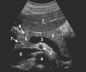 NephroP's tweet image. #POCUS quiz:
What are 1️⃣ - 8️⃣❓
#FOAMed #Nephpearls 
(📷 Radiology key/General and Vascular Ultrasound textbook)