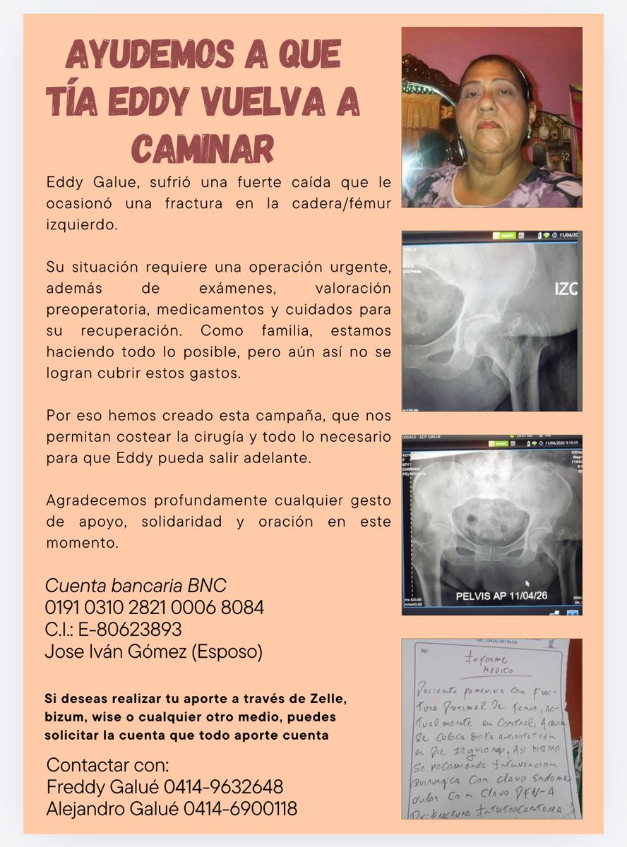 freddygalue's tweet image. Eddy Galué Taborda es mi hermana, tuvo un accidente, tiene fractura de cadera lo cual amerita cirugía y está en Venezuela.

#usa  #Washington  #houston   #españa  #madrid #miami #Traumatologia #traumatologo