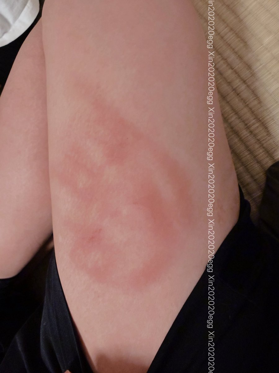 糖芯蛋蛋 3.0 tweet media