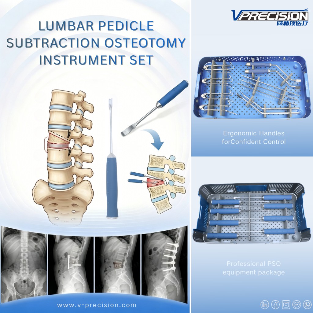 Irisvprecision's tweet image. 💡 Lumbar Pedicle Subtraction Osteotomy (PSO) Instrument Set
Engineered for the precision demands of lumbar pedicle subtraction osteotomy. 
#vprecision #pso #spine #oem