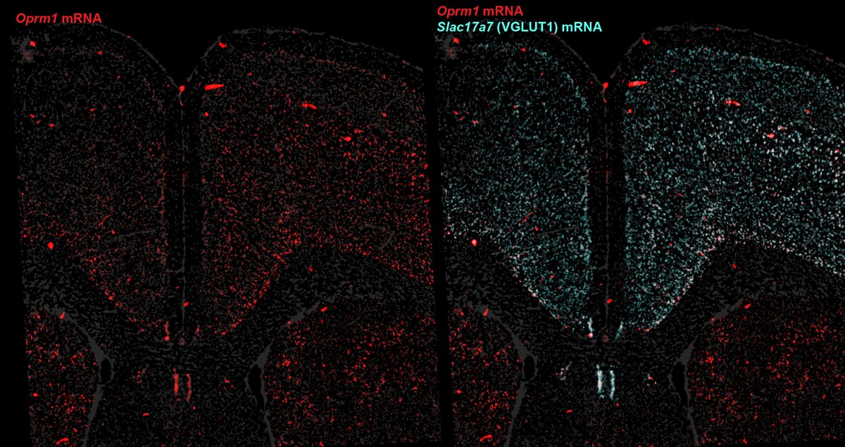 FlyBottleEscape's tweet photo. Really beautiful + rigorous work from the Liston and Levitz Labs combining circuit, molecular, and behavioral approaches to dissect the role of μ-opioid receptors (MOR/OPRM1) in ketamine’s antidepressant effects

One of the central findings is that MORs are enriched in somatostatin (SST) interneurons in cortex, and that these cells play a key role in mediating ketamine’s behavioral effects

There is a lot to like here: the study is technically sophisticated, the circuit logic is compelling, and the SST-dependent mechanism is supported by multiple independent experiments

But stepping back — it’s also critical that we get the cell-type distribution of OPRM1 correct, because this has direct implications for how we think about:
• opioid analgesia
• opioid use disorder
• cortical circuit modulation
• and the design of next-generation MOR-targeting therapeutics

And on that specific point, I think there is a non-trivial dataset interpretation issue worth discussing

The key claim relies heavily on older SMART-seq datasets (ACA/ALM; ~5K cells) from the Allen Institute

These datasets were incredibly important at the time — but they were not designed as unbiased quantitative cellular censuses

A few technical considerations that matter a lot for a gene like Oprm1:

1) Sampling design (not a census)
These datasets rely on:
• targeted dissections (ACA/ALM only)
• FACS-based sorting
• heavy use of transgenic driver lines

This means the data reflect what was selected, not necessarily the true population distribution

2) Cell numbers and statistical power
~5,000 ACA cells total. Once subdivided across excitatory subclasses, power drops quickly

For low-abundance GPCR transcripts like Oprm1, this creates:
• dropout sensitivity
• threshold artifacts
• unstable “presence/absence” calls
• inflated apparent enrichment in small populations

3) SMART-seq recovery biases
Requires intact dissociated cells:
• large projection neurons underrepresented
• pyramidal neurons more fragile
• interneurons often more recoverable

4) Quantification + annotation (2018-era pipelines)
Older gene models + isoform collapsing + exon/intron handling can all affect detection of isoform-complex GPCRs like Oprm1

Now contrast that with newer datasets:
The Allen Brain Cell (ABC) Atlas includes ~4 million cells across the entire mouse brain, with:
• orders-of-magnitude larger sampling
• stable estimates across cortical subclasses
• improved taxonomy
• spatial integration

And importantly — across this dataset, OPRM1 signal is not restricted to SST interneurons

We see the same pattern across:
• our own single-nucleus RNA-seq (100k+ cells)
• Allen ABC Atlas (4 million cells)
• multiplexed FISH
• immunohistochemistry
• n=4 Oprm1-Cre mouse lines
• MORp viral promoter strategies

Across all of these orthogonal approaches, the result is highly consistent:
→ OPRM1/MOR is enriched in glutamatergic cortical populations, not exclusively confined to SST interneurons

So how do we reconcile this?
The most parsimonious explanation is not that either dataset is “wrong,” but that they are answering different questions under different constraints:
SMART-seq (2018):
→ high depth, small N, targeted sampling
→ vulnerable for sparse genes
ABC-scale (modern):
→ massive N, robust population estimates
→ better suited for cell-type distribution
For genes like Oprm1 — low abundance, heterogeneous, biologically critical —
 scale + sampling design + cross-modal validation are decisive

The broader point:
As a field, we need to be careful about making strong claims about cell-type specificity of neuromodulatory receptors based on early-generation datasets — especially when:
• atlas-scale data now exist
• multiple orthogonal methods converge
• and the implications extend to therapeutics

None of this detracts from the importance of SST interneurons in MOR-dependent circuit function — that biology may be very real and important

But the global cortical distribution of OPRM1 appears broader, and heavily includes glutamatergic neurons

And that distinction matters for new appraoches for depression, pain and OUD