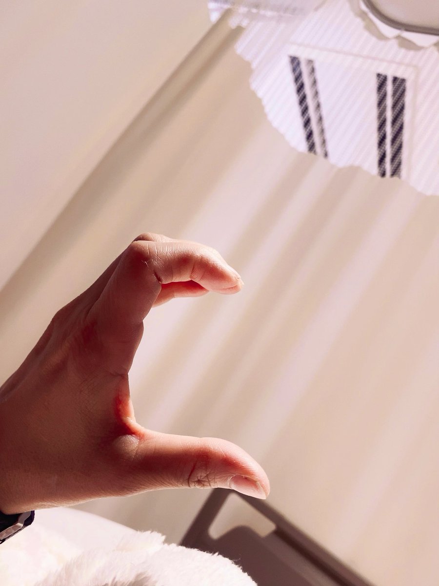 手術から、ちょうど一ヶ月
元気にいられるのも主治医の先生始め
周りにいる皆さんのおかげです☺️🫶

2ヶ月後にポート入れて治療が始まり、再建手術前のエキスパンダー入れること考えたらあと３回は入院が必要だなと…
先はまだ長いですが前向きにライブしながら楽しく歩んでいきますね🙌

#乳がん