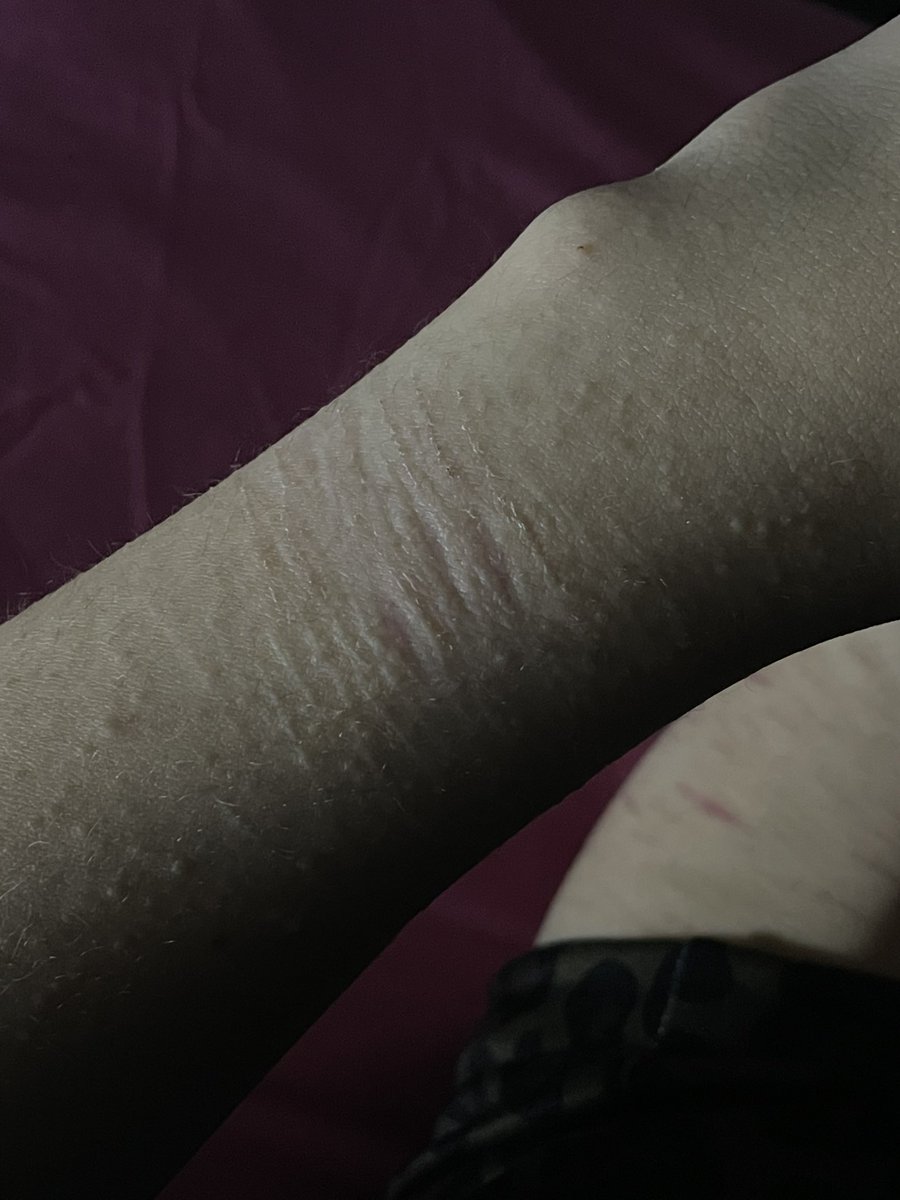 liam🦔 tweet media