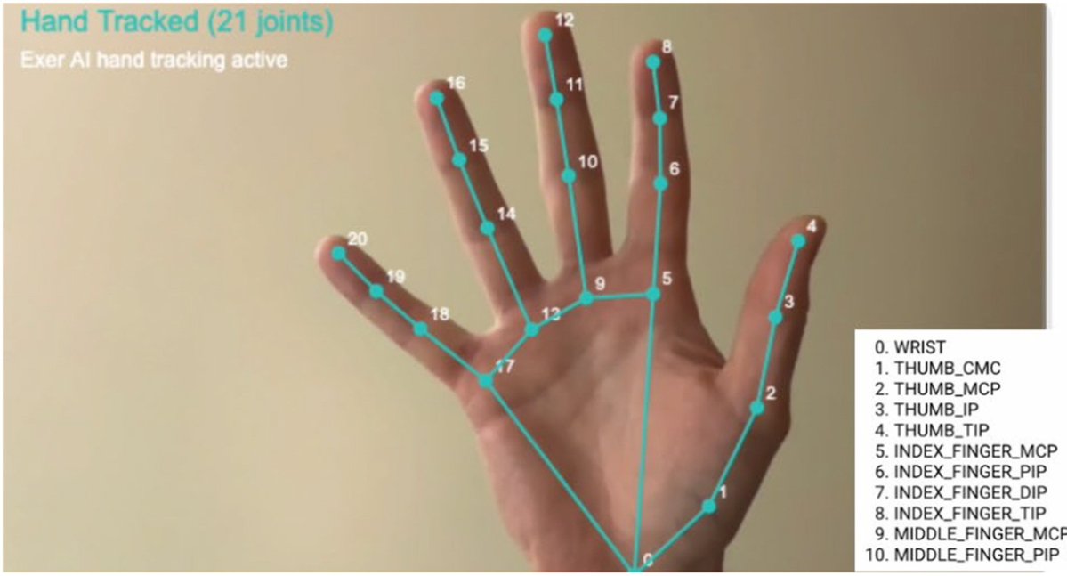 JHandSurg's tweet image. Can a 2D artificial intelligence (AI) app accurately and reliably measure hand, wrist, and forearm range of motion? Find out in the April 2026 issue of JHS! 

jhandsurg.org/article/S0363-…

#JHS #ArtificialIntelligence #camera #app #2-dimensional #2D #motion #ROM