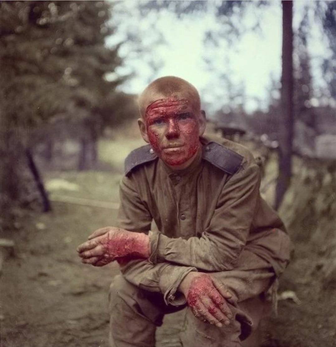 Советский солдат, выживший в сгоревшем танке. 

Вглядитесь в это простое русское лицо. 
Лицо человека, который спас не только свою Родину, но и этот мир от коричневой чумы!
waralbum.ru/195056/