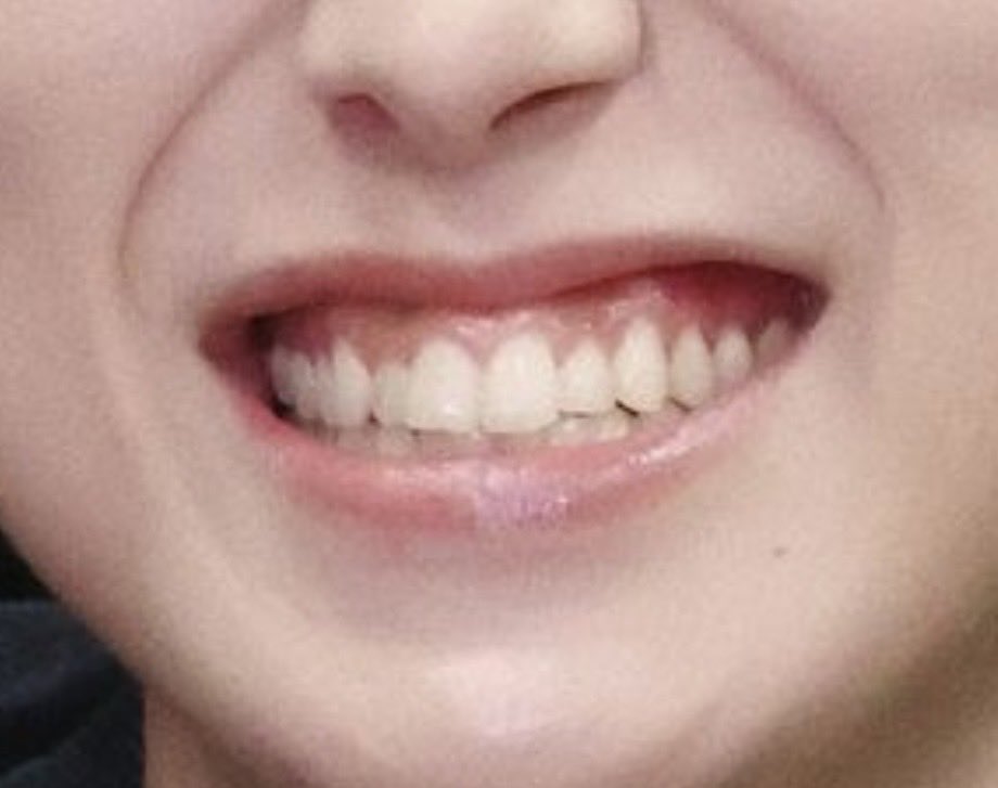 &teeth tweet media