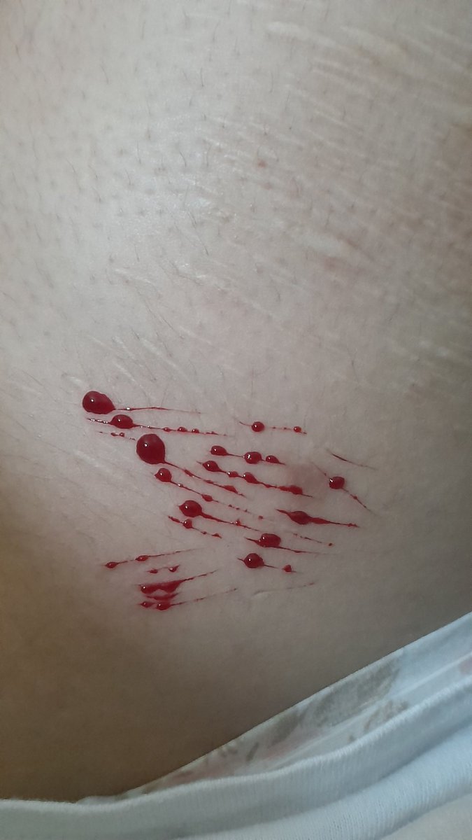 konicigarettes's tweet photo. Recov de mrd, me hizo más blando, ahora solo pudo hacerme rasguños. 👎🏻 https://t.co/vu7mEcyiq2