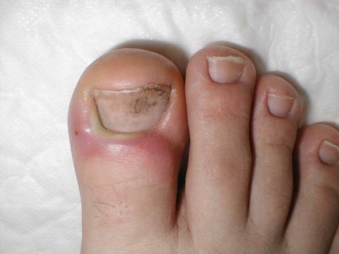 CardiovascularCorner tweet media