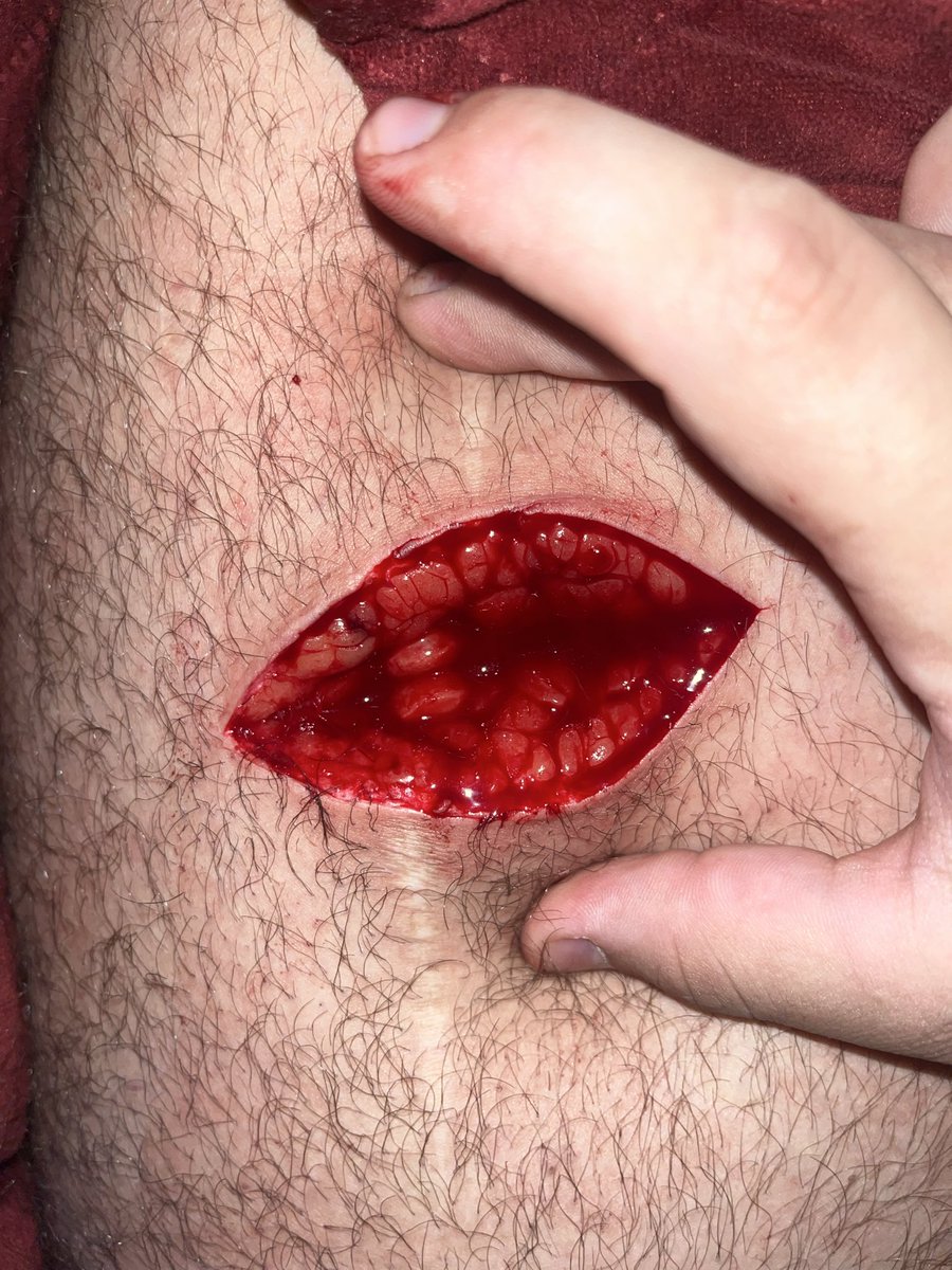 CrazyAYex's tweet photo. #shtwt ALL FAKE SFX MAKEUP https://t.co/w8GLhFj5Uc