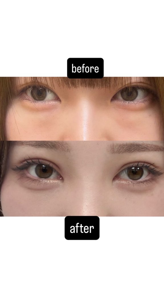 りさ🎀美容垢 tweet media